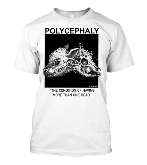 Polycephaly The Condition Of Having More Than One Head T-Shirt