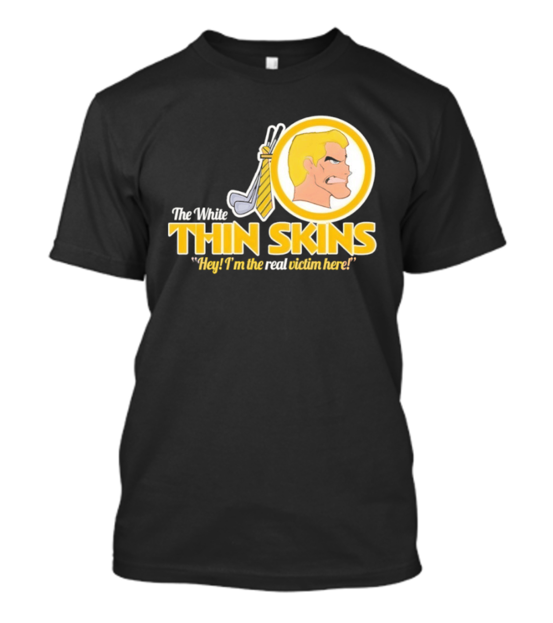 The White Thin Skins Hey I'm The Real Victim Here T-Shirt