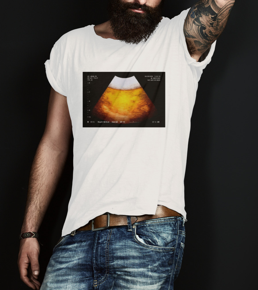 Beer Ultrasound Image Not Safe For Liver T-Shirt