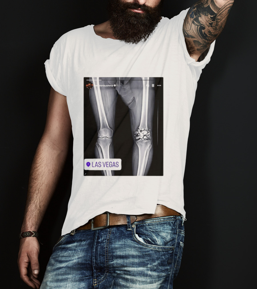 Conor McGregor X Ray Broken Knee Las Vegas T-Shirt